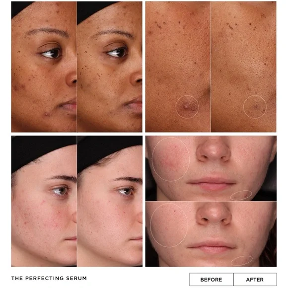 LALAIS The Perfecting Serum - Picture 7 of 8